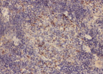 WAS Rabbit Polyclonal Antibody