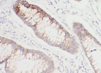 WBP1 Antibody