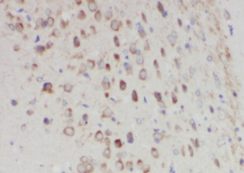 GALNT17 Antibody