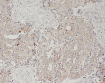 WDFY3 Antibody