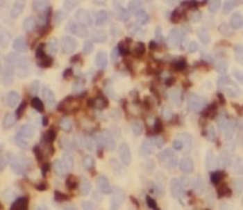 WDFY4 Antibody