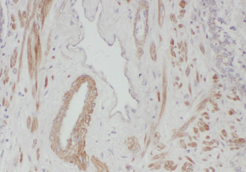WDR19 Antibody