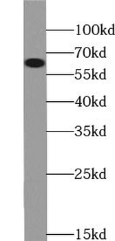 DCAF10 Rabbit Polyclonal Antibody