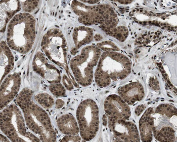DCAF10 Antibody