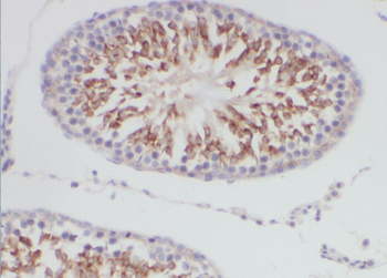 DCAF12 Antibody