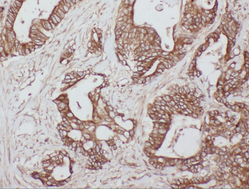 WDR55 Antibody