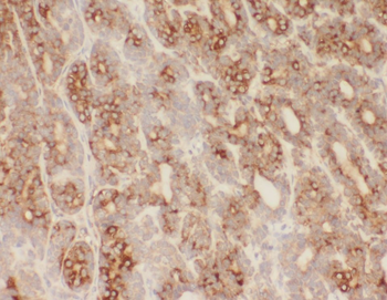 WDR7 Antibody