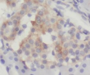 WFDC3 Antibody
