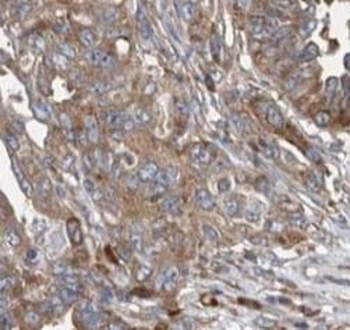 WT1 AS Rabbit Polyclonal Antibody