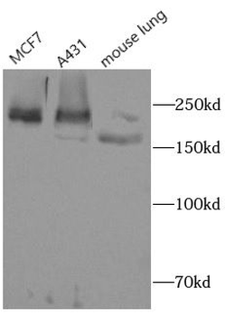 WRN Rabbit Polyclonal Antibody