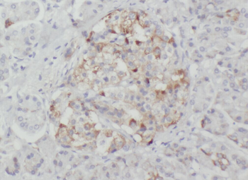 WSB2 Antibody