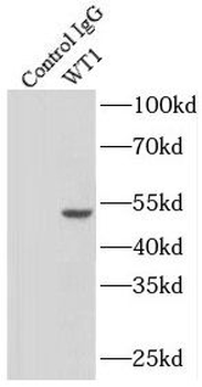 WT1 Antibody