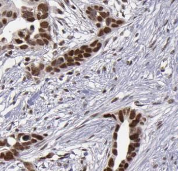 WT1 Antibody