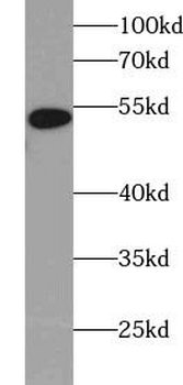 WTAP Antibody