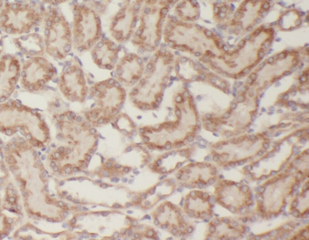 AMER1 Antibody