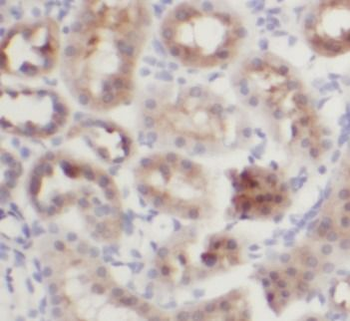 WWC2 Antibody