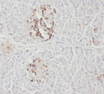 WWP2 Antibody