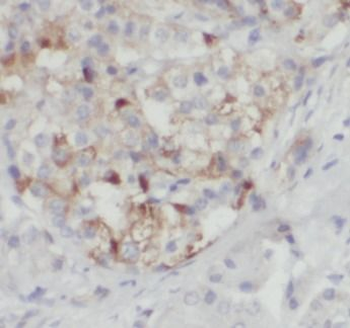 XIAP Antibody