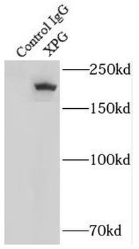 ERCC5 Antibody