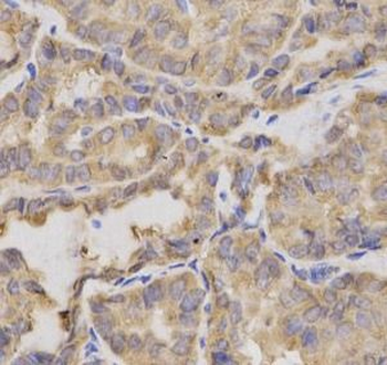 XRCC2 Antibody