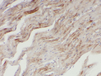 XRN1 Antibody