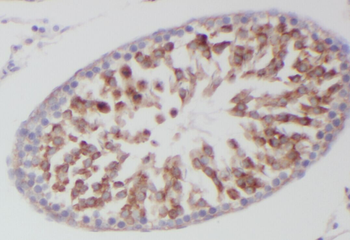 YARS2 Antibody