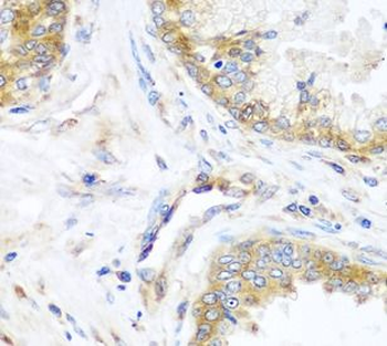 YBX1 Antibody