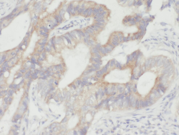 YME1L1 Antibody