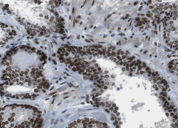 YPEL5 Antibody