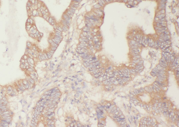 YWHAB Rabbit Polyclonal Antibody