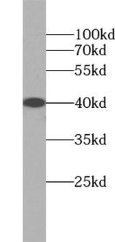PTGR3 Antibody