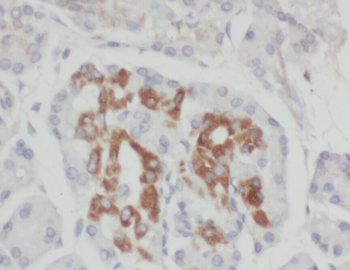 PTGR3 Antibody