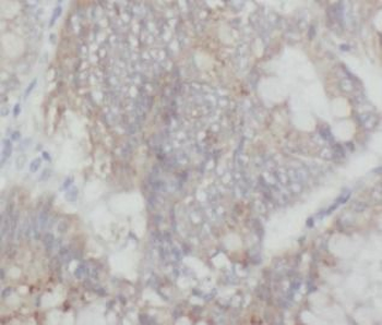 MAP3K20 Antibody