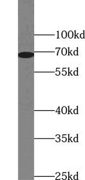ZAP70 Mouse Monoclonal Antibody