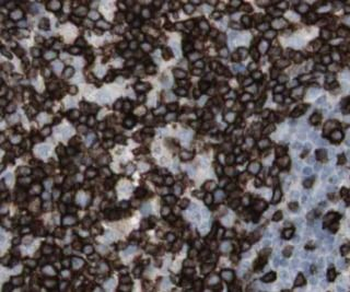 ZAP70 Mouse Monoclonal Antibody