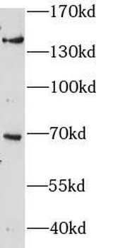 ZBTB11 Antibody