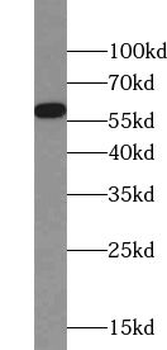 ZBTB37 Rabbit Polyclonal Antibody