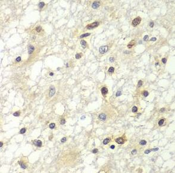 ZBTB48 Antibody