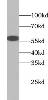 ZBTB7B Antibody