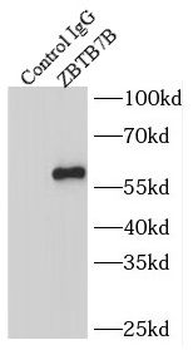 ZBTB7B Antibody