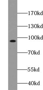 ZC3H11A Rabbit Polyclonal Antibody