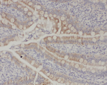 ZC3H12A Antibody