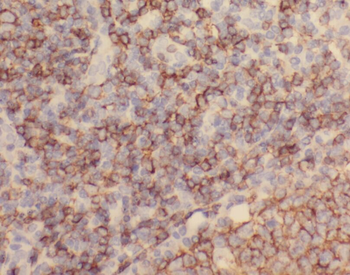 ZC3H12D Antibody