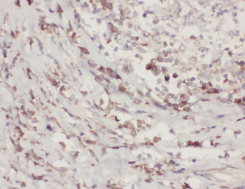 ZC3H4 Antibody
