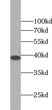 ZC3HAV1L Rabbit Polyclonal Antibody