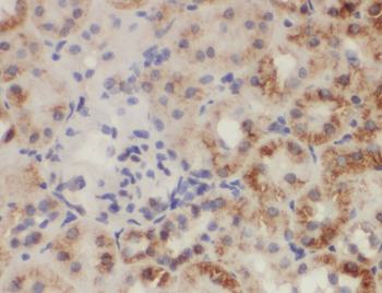 ZC3HAV1L Rabbit Polyclonal Antibody