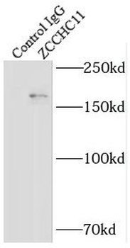TUT4 Antibody