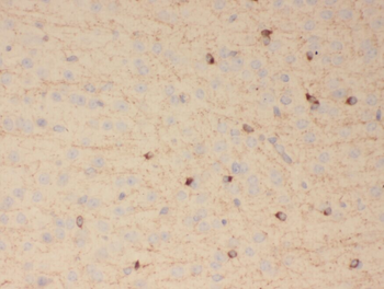 TUT4 Antibody