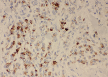ZDHHC13 Antibody