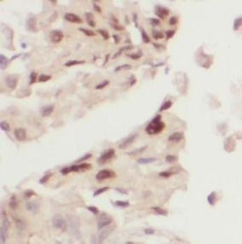 ZEB1 Antibody